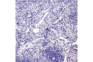 IHC testing of FFPE rat spleen tissue with HE4 antibody at 0. (WFDC2 anticorps  (AA 31-124))