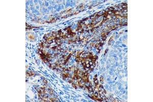 Immunohistochemistry of paraffin-embedded Rat ovary using PIGU Rabbit pAb (ABIN7269291) at dilution of 1:100 (40x lens).