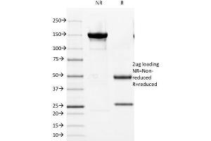 SDS-PAGE Analysis of Purified Cytokeratin 8 Mouse Monoclonal Antibody (KRT8/803). (KRT8, KRT18 anticorps)