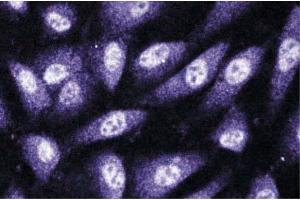 Immunofluorescence staining of human endothelial cells. (CNKSR1 anticorps  (AA 10-217))