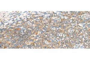Immunohistochemistry of paraffin-embedded Human tonsil tissue using TTLL1 Polyclonal Antibody at dilution of 1:60(x200) (TTLL1 anticorps)
