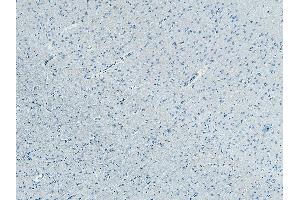 anti-F-Box and Leucine-Rich Repeat Protein 2 (FBXL2) (N-Term) antibody