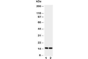 Western blot testing of FABP5 antibody and Lane 1:  rat liver;  2: rat kidney tissue lysate