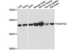 Western blot analysis of extracts of various cell lines, using NDUFS2 antibody. (NDUFS2 anticorps  (AA 204-463))