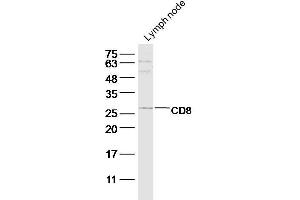 Mouse lymph node lysate probed with CD8a Polyclonal Antibody at 1:300 overnight in 4˚C. (CD8 anticorps  (AA 101-200))