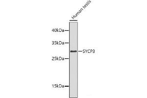 Western blot analysis of extracts of Human testis using SYCP3 Polyclonal Antibody. (SYCP3 anticorps)