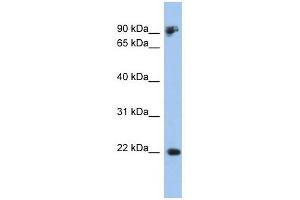 CDH1 antibody used at 1 ug/ml to detect target protein. (E-cadherin anticorps)