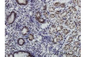 Image no. 1 for anti-Transcriptional Adaptor 2B (TADA2B) (AA 2-111) antibody (ABIN466261) (TADA2B anticorps  (AA 2-111))