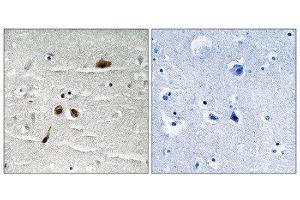 Immunohistochemistry (IHC) image for anti-Mdc1 (MDC1) (pSer513) antibody (ABIN1847790) (MDC1 anticorps  (pSer513))