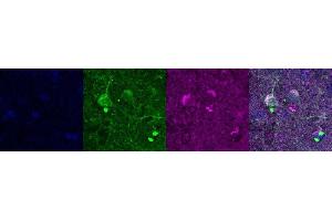 Immunohistochemistry (IHC) image for anti-Microtubule-Associated Protein 2 (MAP2) antibody (ABIN7455981)