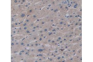 IHC-P analysis of Kidney tissue, with DAB staining. (GGPS1 anticorps  (AA 1-290))