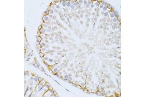 Immunohistochemistry of paraffin-embedded rat testis using PIKFYVE antibody (ABIN5974035) at dilution of 1/100 (40x lens). (PIKFYVE anticorps)