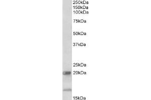 ABIN1590138 (2µg/ml) staining of Human Ileum lysate (35µg protein in RIPA buffer).