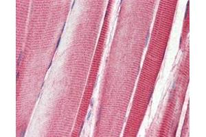Immunohistochemical analysis of paraffin-embedded human skeletal musle tissues using DDR2 mouse mAb.