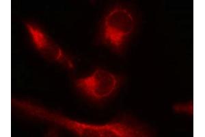Immunofluorescence staining of methanol-fixed Hela cells using Tau(Phospho-Ser356) Antibody. (MAPT anticorps  (pSer356))