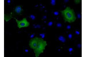 Image no. 5 for anti-Bruton Agammaglobulinemia tyrosine Kinase (BTK) antibody (ABIN1496971) (BTK anticorps)