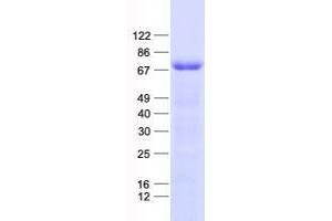 Validation with Western Blot