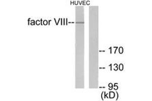 Western blot analysis of extracts from HuvEc cells, using Factor VIII Antibody.