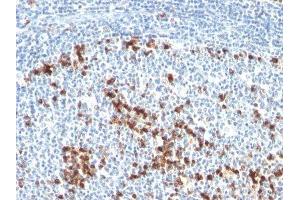 Image no. 2 for Mouse anti-Human kappa Light Chain antibody (ABIN6174183) (Souris anti-Humain kappa Light Chain Anticorps)