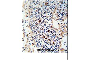 Kappa light chain Antibody (ABIN1539833 and ABIN2843812) immunohistochemistry analysis in formalin fixed and paraffin embedded human lymph tissue followed by peroxidase conjμgation of the secondary antibody and DAB staining. (kappa Light Chain anticorps)