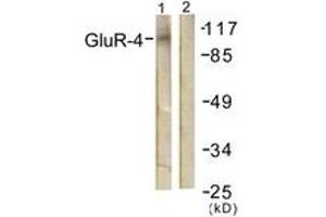 Western blot analysis of extracts from NIH-3T3 cells, treated with Forskolin 40nM 30', using GluR4 (Ab-862) Antibody.