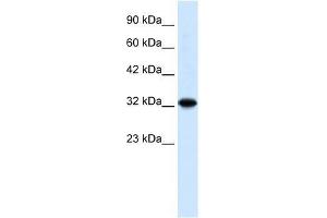 ZBTB32 antibody used at 0. (ZBTB32 anticorps  (N-Term))