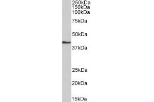 ABIN5539536 (0. (HMBS anticorps  (AA 160-173))