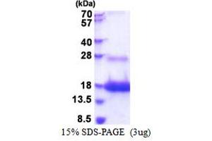 SDS-PAGE (SDS) image for Lymphocyte Antigen 6 Complex, Locus D (LY6D) (AA 21-98) protein (His tag) (ABIN5853487) (LY6D Protein (AA 21-98) (His tag))