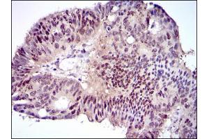 Immunohistochemical analysis of paraffin-embedded rectum tissues using CEBPA mouse mAb with DAB staining.