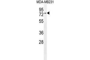 Tiparp Antibody (C-term) western blot analysis in MDA-MB231 cell line lysates (35 µg/lane). (Tiparp anticorps  (C-Term))