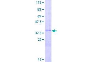 Image no. 1 for Parathyroid Hormone (PTH) (AA 1-115) protein (GST tag) (ABIN1316767)
