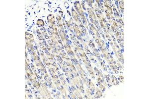 Immunohistochemistry of paraffin-embedded mouse stomach using MAPKBP1 antibody at dilution of 1:100 (x40 lens).