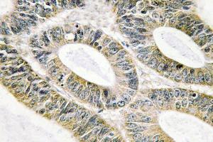 Immunohistochemistry analysis of Galectin-9 antibody . (Galectin 9 anticorps)