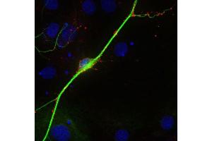 Indirect immunostaining of PFA fixed rat hippocampus neurons with anti-synaptoporin (1 : 500; red) and mouse anti-MAP 2 (cat. (Synaptoporin anticorps)