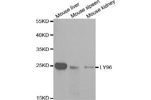Western blot analysis of extracts of various cell lines, using LY96 antibody (ABIN5970959) at 1/1000 dilution. (LY96 anticorps)