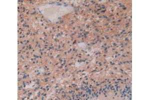 Used in DAB staining on fromalin fixed paraffin- embedded glioma tissue (IL29 anticorps  (AA 20-200))