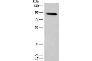 Western blot analysis of Human plasma solution using C1R Polyclonal Antibody at dilution of 1:800 (C1R anticorps)