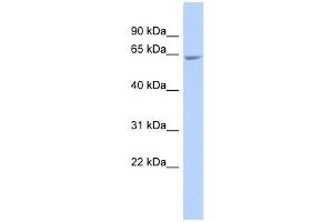 GALNTL4 antibody used at 1 ug/ml to detect target protein. (UDP-N-Acetyl-alpha-D-Galactosamine:polypeptide N-Acetylgalactosaminyltransferase 18 (GALNT18) (Middle Region) anticorps)