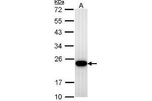 WB Image Transgelin antibody detects TAGLN protein by Western blot analysis. (Transgelin anticorps)