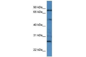 Human HCT15; WB Suggested Anti-GOLGA1 Antibody Titration: 0. (GOLGA1 anticorps  (Middle Region, N-Term))