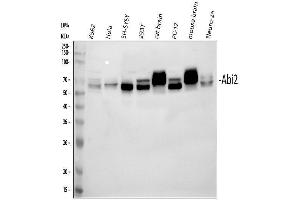 Western blot analysis of ABI2 using anti-ABI2 antibody (ABIN7600125).
