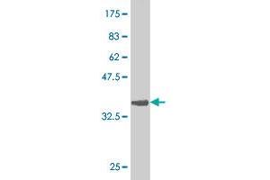 Western Blot detection against Immunogen (36. (Nucleostemin anticorps  (AA 328-427))