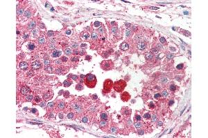 Anti-EIF3M / PCID1 antibody IHC of human testis. (Eukaryotic Translation Initiation Factor 3, Subunit M (EIF3M) (AA 355-366) anticorps)