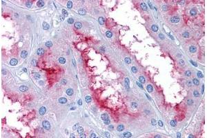 Human Kidney: Formalin-Fixed, Paraffin-Embedded (FFPE) (GCC2 anticorps  (AA 1174-1185))