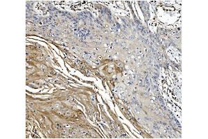 IHC analysis of GSDMD using anti-GSDMD antibody (ABIN7599433). (GSDMD anticorps  (AA 1-484))