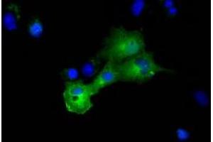 Anti-DYNC1LI1 mouse monoclonal antibody (ABIN2452966) immunofluorescent staining of COS7 cells transiently transfected by pCMV6-ENTRY DYNC1LI1 (RC222010). (DYNC1LI1 anticorps)