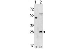 Image no. 1 for anti-Proteasome Subunit alpha 5 (PSMA5) (N-Term) antibody (ABIN356944) (PSMA5 anticorps  (N-Term))