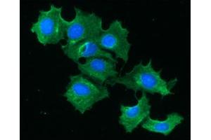 ICC/IF analysis of FABP1 in Hep3B cells line, stained with DAPI (Blue) for nucleus staining and monoclonal anti-human FABP1 antibody (1:100) with goat anti-mouse IgG-Alexa fluor 488 conjugate (Green).