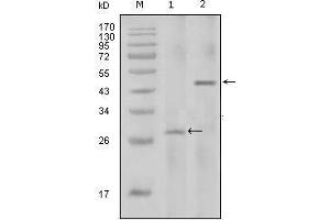 Western blot analysis using IL2 mouse mAb against full-length IL2 recombinant protein with Trx tag (1) and full-length IL2-hIgGFc transfected HEK293 cell lysate(2). (IL-2 anticorps)