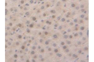 Used in DAB staining on fromalin fixed paraffin-embedded Liver tissue (GSTa5 anticorps  (AA 1-221))